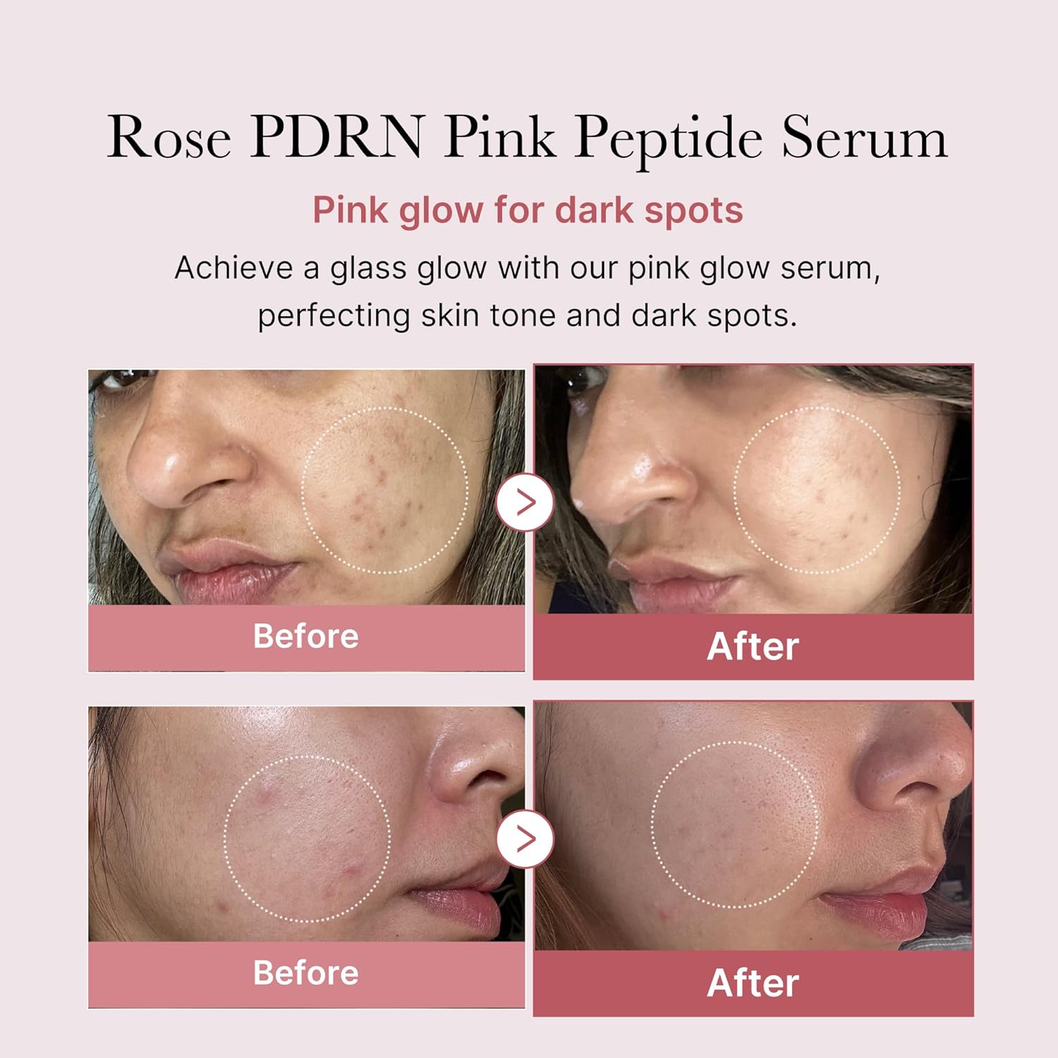 [MEDICUBE] Collagen PDRN Pink Peptide Serum 30ml