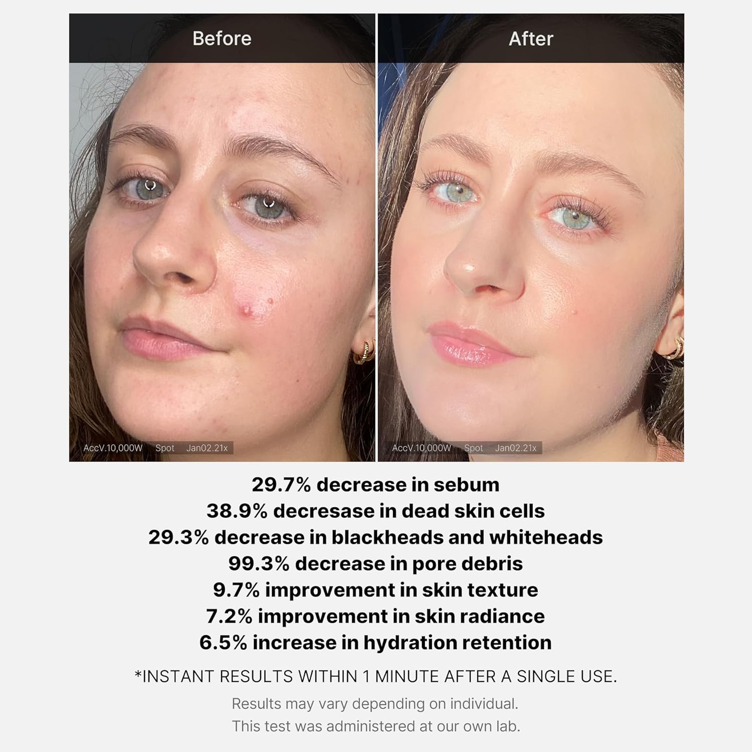 [MEDICUBE] Red Acne Succinic Acid Peel 40g