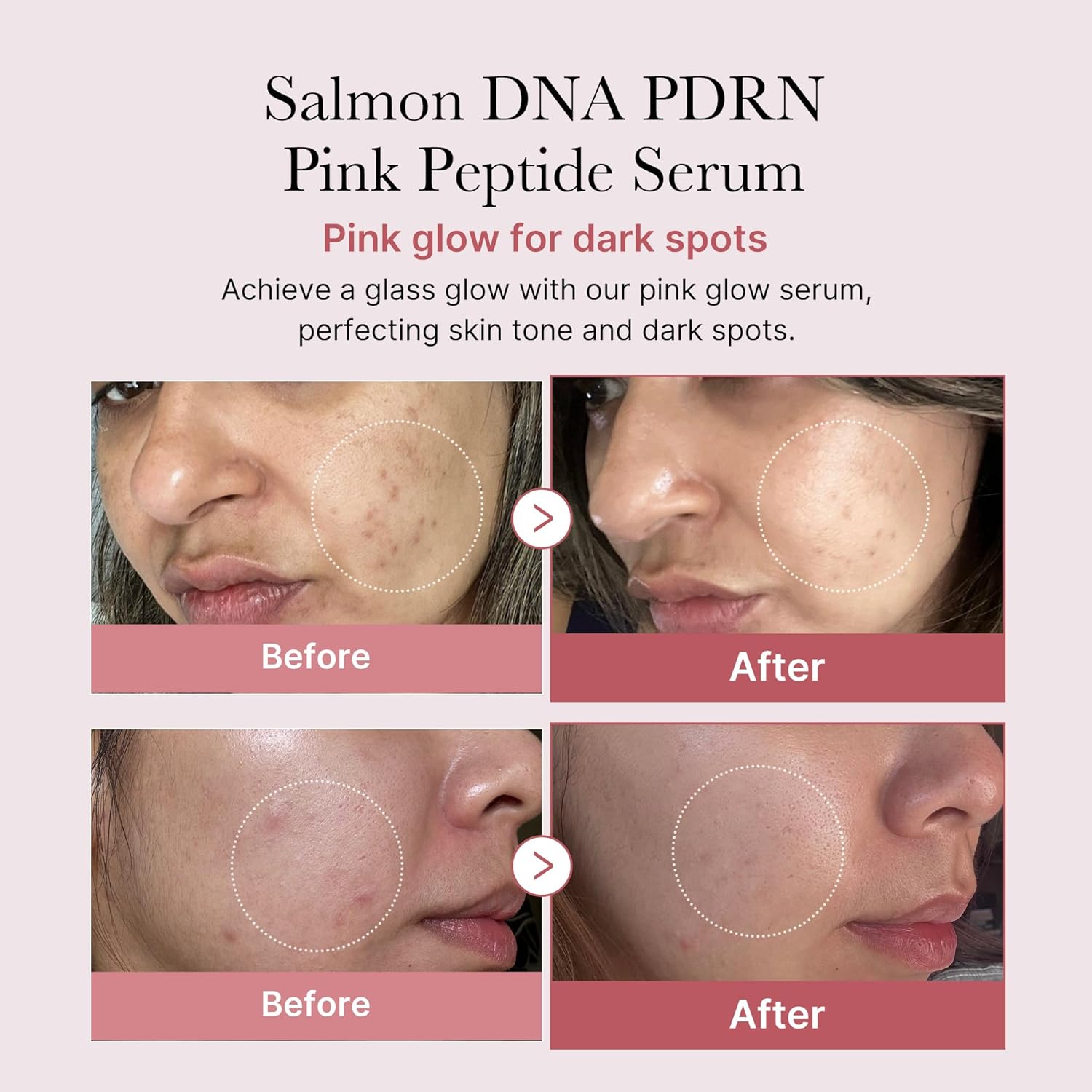 [MEDICUBE] Collagen PDRN Pink Peptide Serum Duo