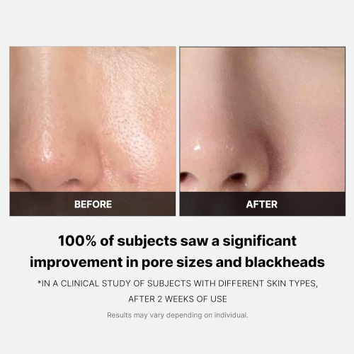 [MEDICUBE] Zero Pore Pad 2.0 (70ea)